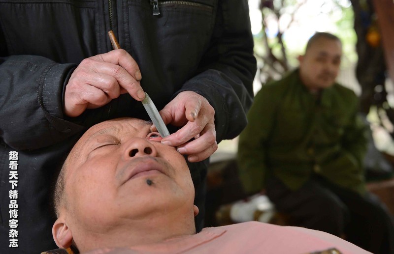Eye Cleaning In China